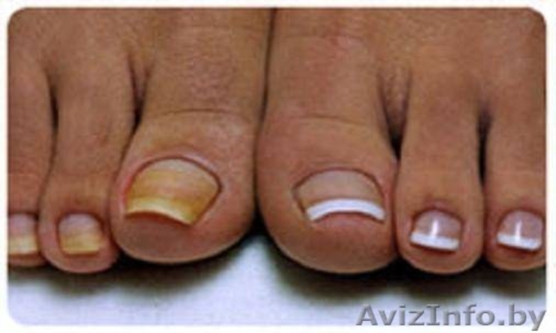 профессиональное наращивание ногтей - Изображение #3, Объявление #100671